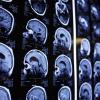 Por primera vez en el mundo, Hospital Civil utiliza equipo de Tomografía óptica