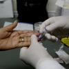Arranque de la Campaña de la Lucha contra la Hepatitis del 28 al 31 de julio que se realizará con motivo del “Día Mundial contra la Hepatitis”. La campaña está dirigida a quienes hayan recibido transfusiones antes de 1995, pacientes con VIH/SIDA, familiares convivientes y parejas sexuales de personas infectadas,  personas que padecen hemofilia o insuficiencia renal, personas que compartan jeringas, personas que se hayan tatuado, recibido tratamiento con acupuntura o jeringas no desechables, así como persona